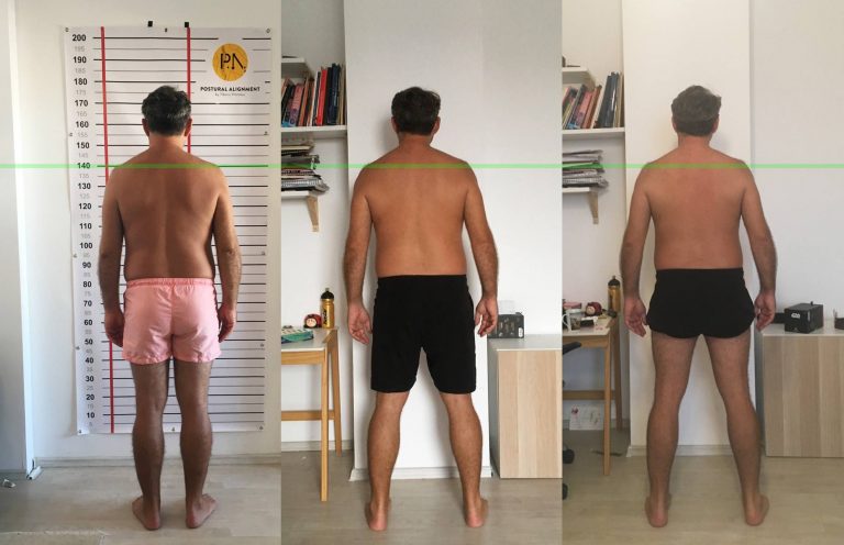 Postural Alignment